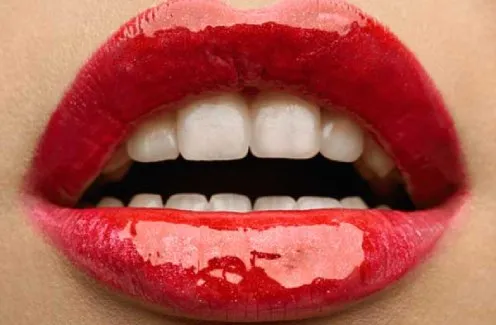 Digital Dental Photography