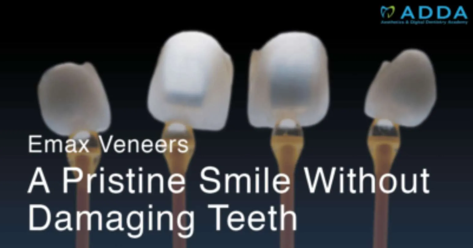Emax Veneers: A Pristine Smile without Damaging Teeth