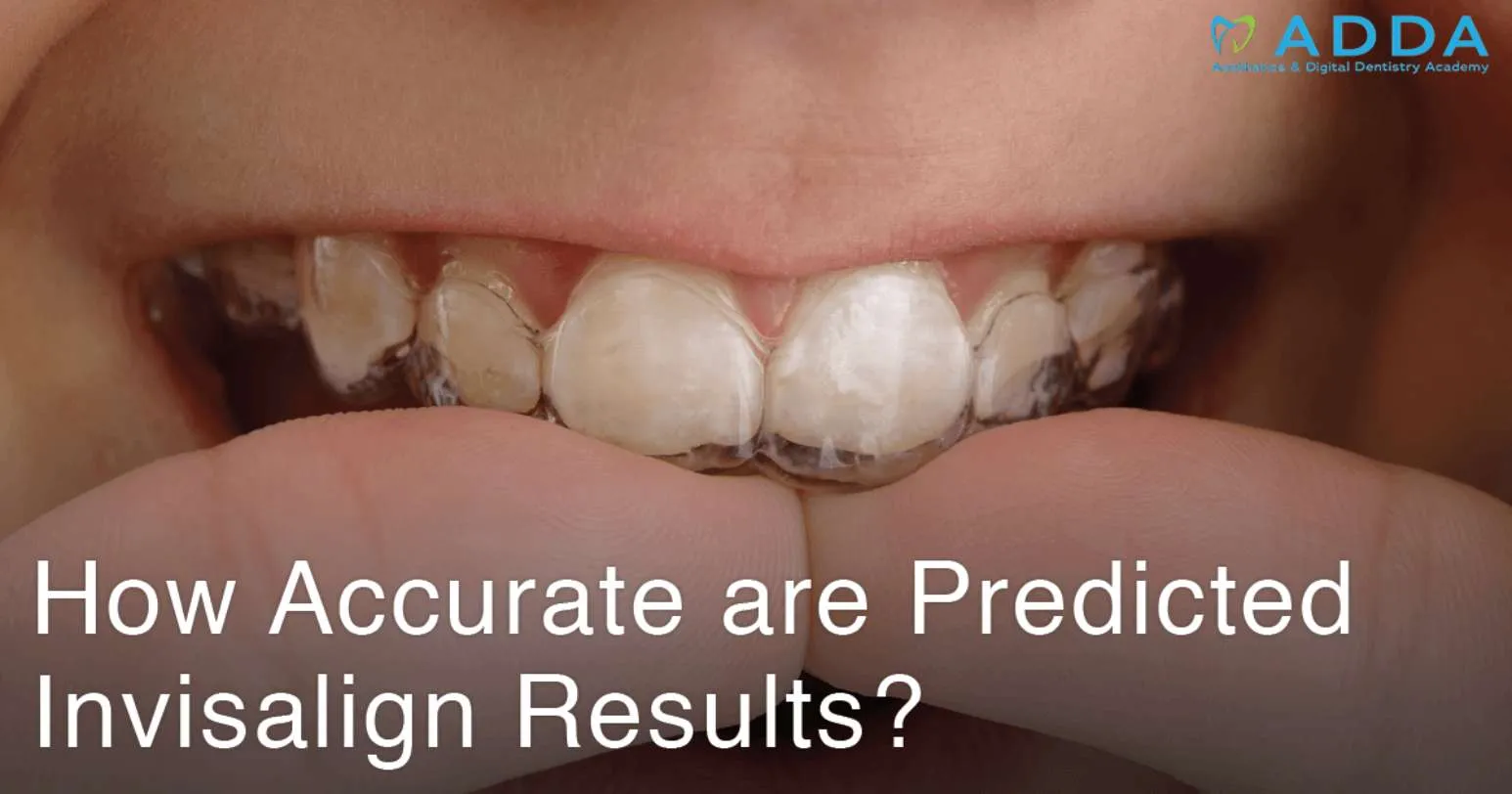 How Accurate are Predicted Invisalign Results?