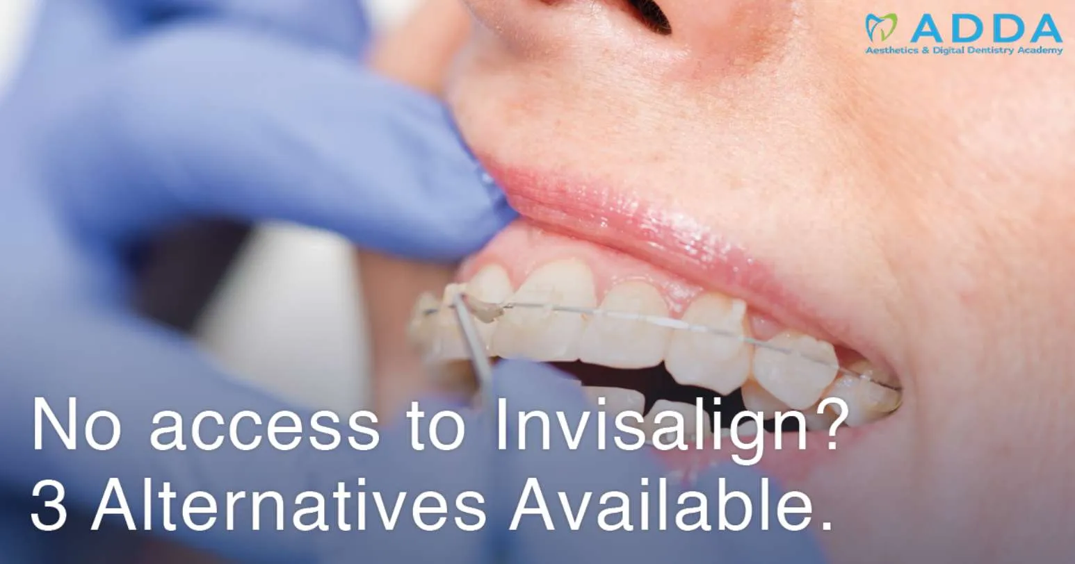 No Access to Invisalign? 3 Alternatives Available.