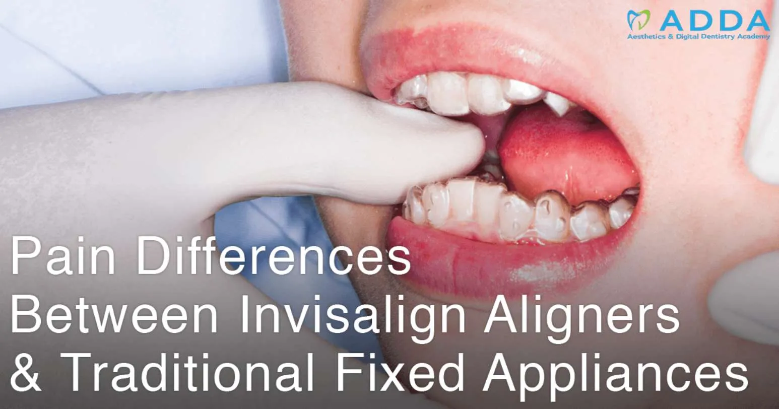 Pain Differences Between Invisalign Aligners & Traditional Fixed Appliances
