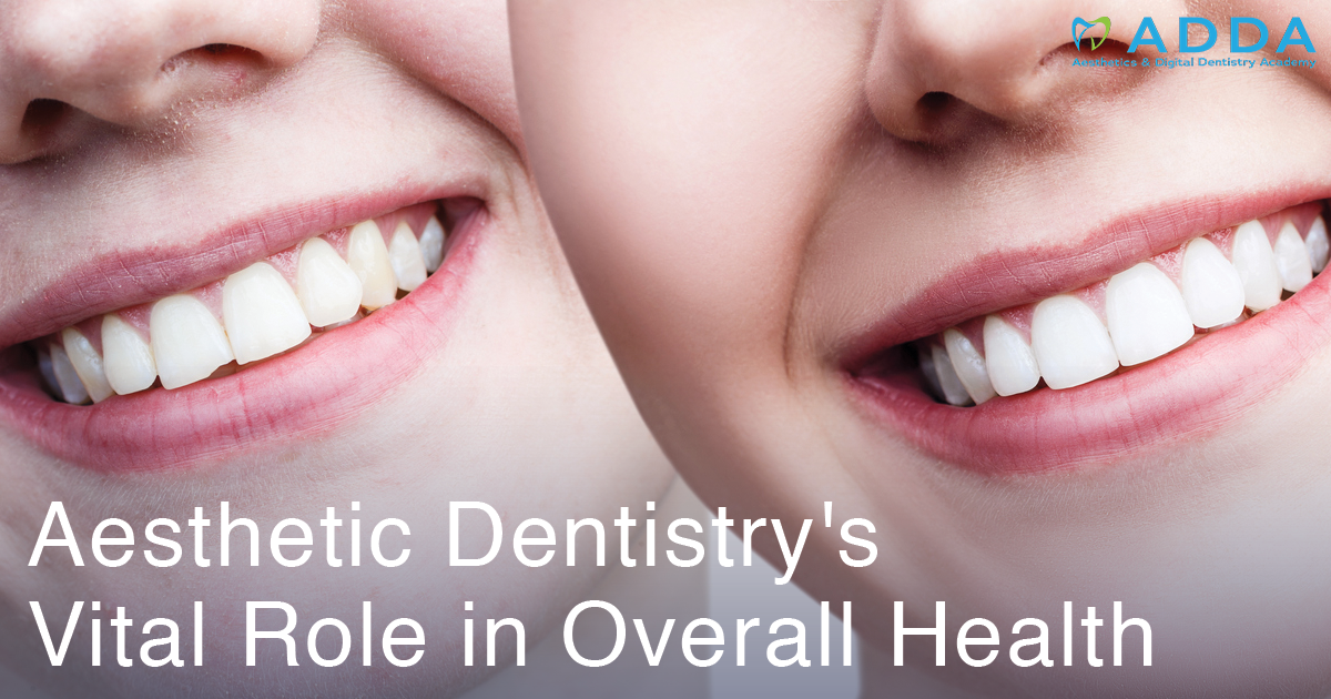 Aesthetic Dentistry's Vital Role in Overall Health